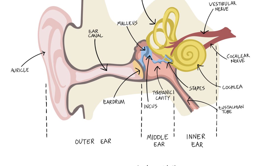 vestibular neuritis